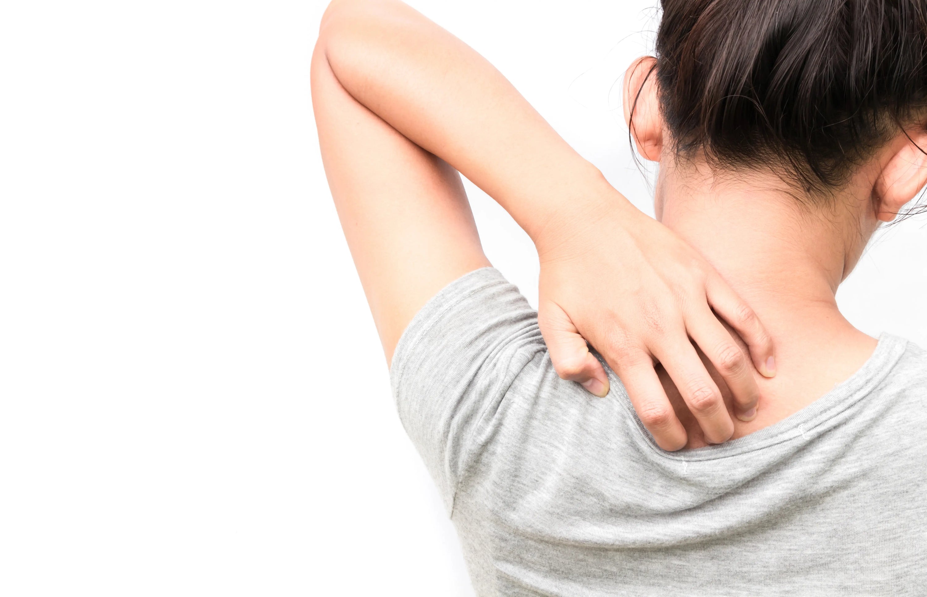 The Best Remedies for Bug Bites, Poison Ivy and Itchy Skin