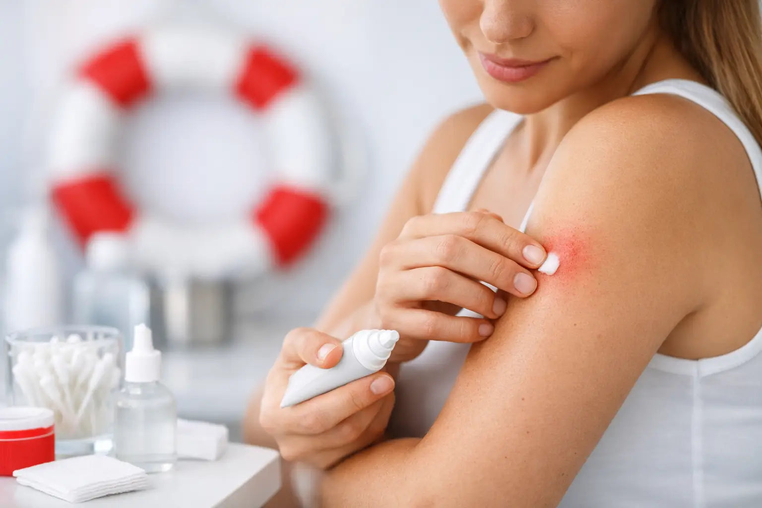 What Helps Itchy Mosquito Bites? 7 Smart Moves