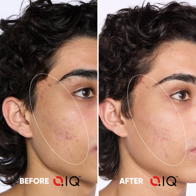 Your Skin Savior Bundle