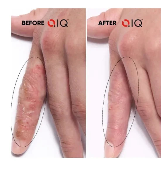 Before and after photos showing Brooke's hands
